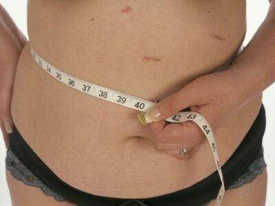 Restore or Enhance Your Appearance with Tummy Tuck Specialists in New Jersey Tummy Tuck Specialists in New Jersey