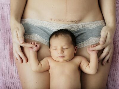 C-Section or Vaginal Delivery - Which Is Right For You? C-Section or Vaginal Delivery