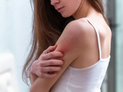 Itchy Skin