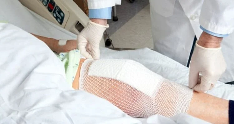 Arthroscopic Knee Surgery