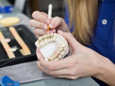 Porcelain Veneers