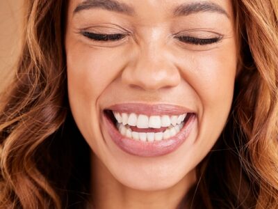 Smile Makeover