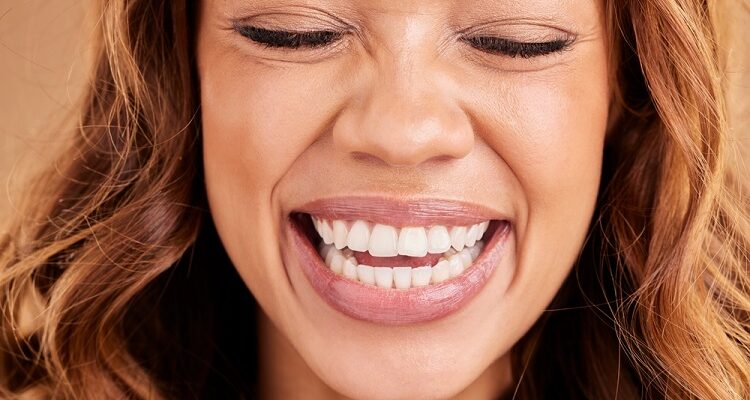 A Smile Makeover Journey: From Consultation to Confident Grin Smile Makeover