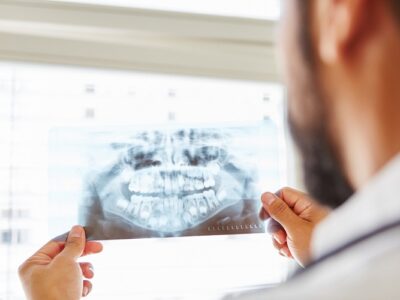 maxillofacial surgery,